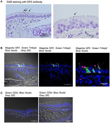 Airway M Cells Arise in the Lower Airway Due to RANKL Signaling and Reside in the Bronchiolar Epithelium Associated With iBALT in Murine Models of Respiratory Disease